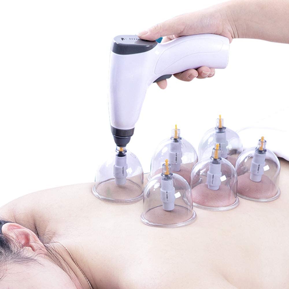 Conjunto de ventosas elétricas - Cupping Therapy Set avaliação e preço