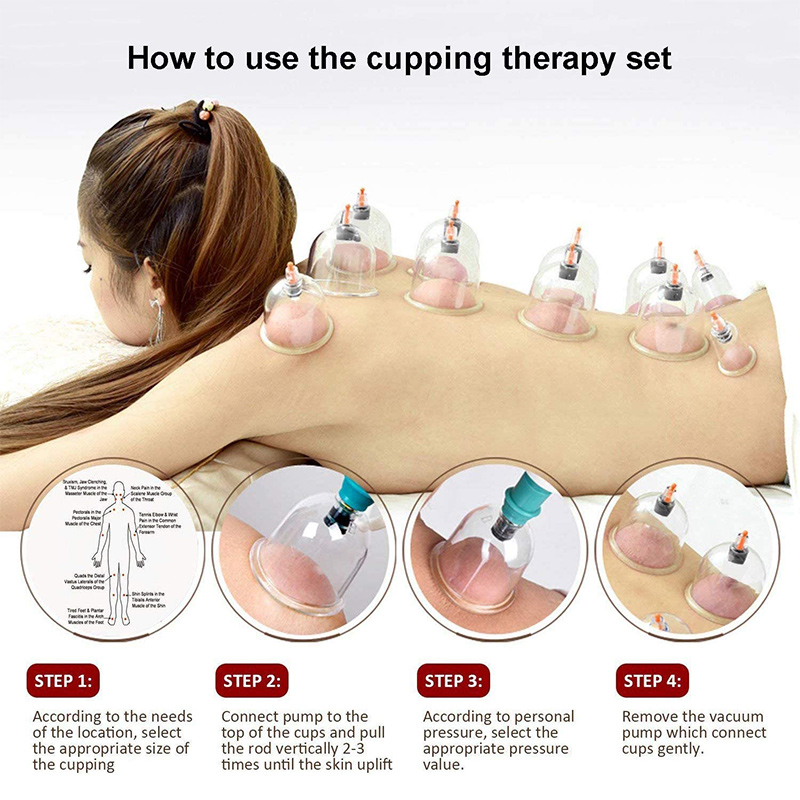 6 ou 24 peças ventosas massage - Cupping Therapy Set avaliação e preço