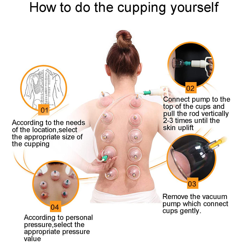 6 ou 24 peças ventosas massage - Cupping Therapy Set avaliação e preço
