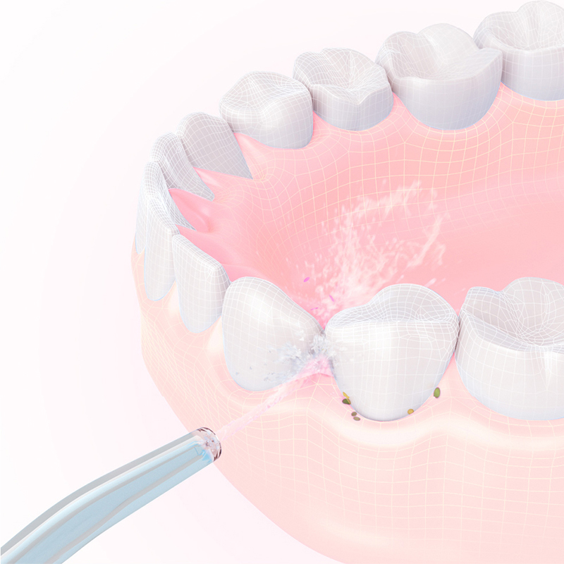 Bicos de fio dental de água de - Oral Irrigator Flosser avaliação e preço